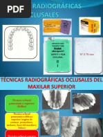 Proyección de Waters en Radiología | PDF | Cabeza y cuello humanos ...