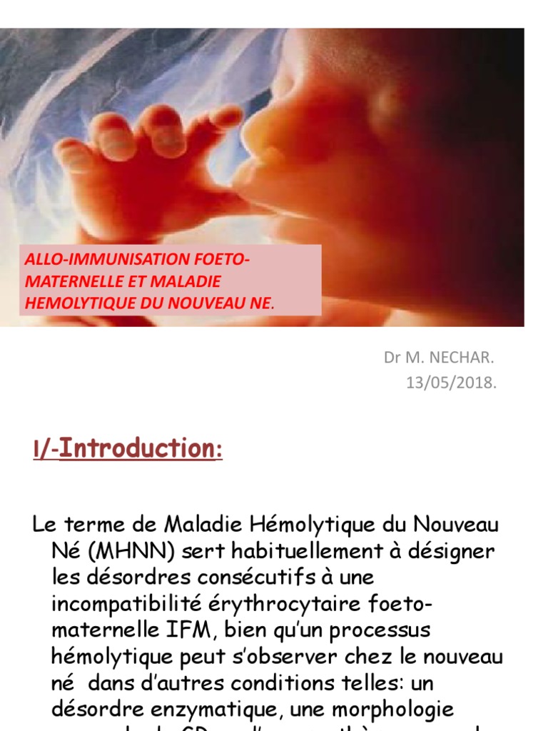 Qu’Est-Ce Que La Maladie Hémolytique Du Nouveau-Né – FPYFD