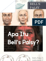 Bell’s Palsy