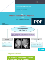 Presentacion Macroadenoma Hipofisiario