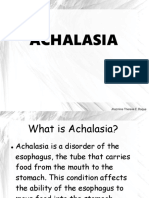 Achalasia: Jhazmine Therese F. Roque