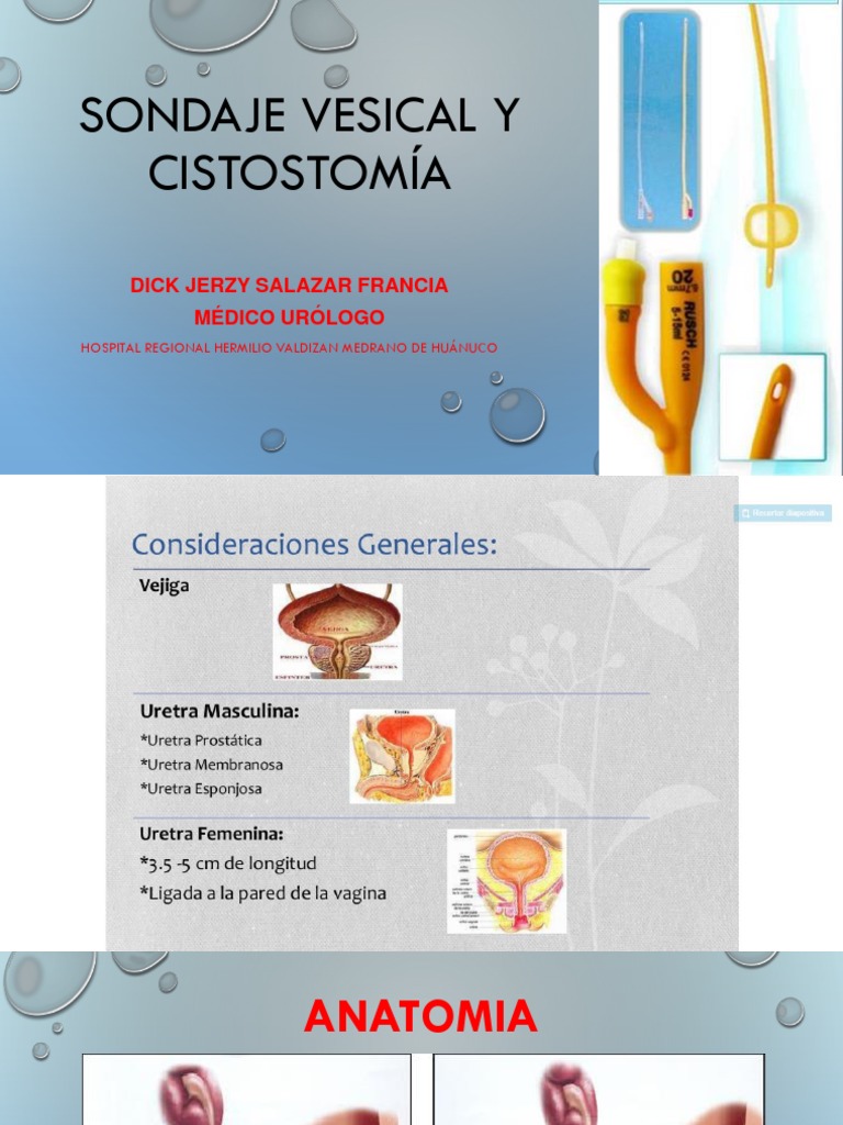 Sondaje Vesical y Cistostomía | PDF