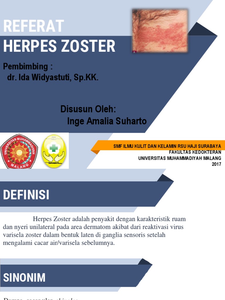 Referat Herpes Zoster