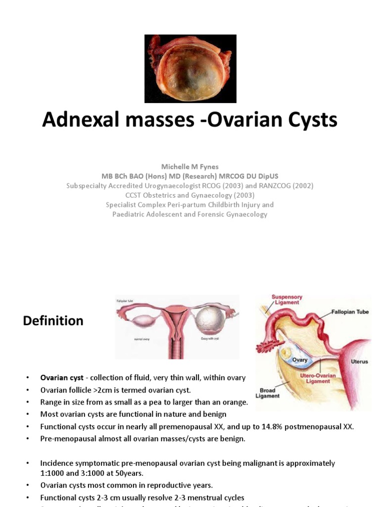 Understanding Adnexal Masses and Cysts | PDF | Ovarian Cancer | Women's ...