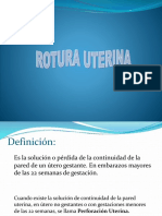 Rotura uterina: causas, clasificación, diagnóstico y tratamiento