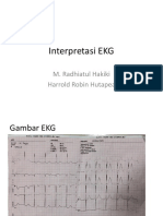 Interpretasi EKG