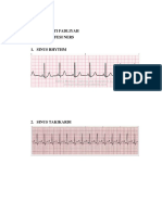 Ekg