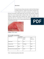 Recurrent Aphthous Stomatitis