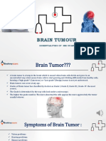MRI Scan - Brain Tumor
