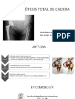 Artrosis de Cadera y Esguince de Tobillo