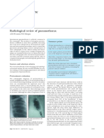 Clinical Review: Radiological Review of Pneumothorax