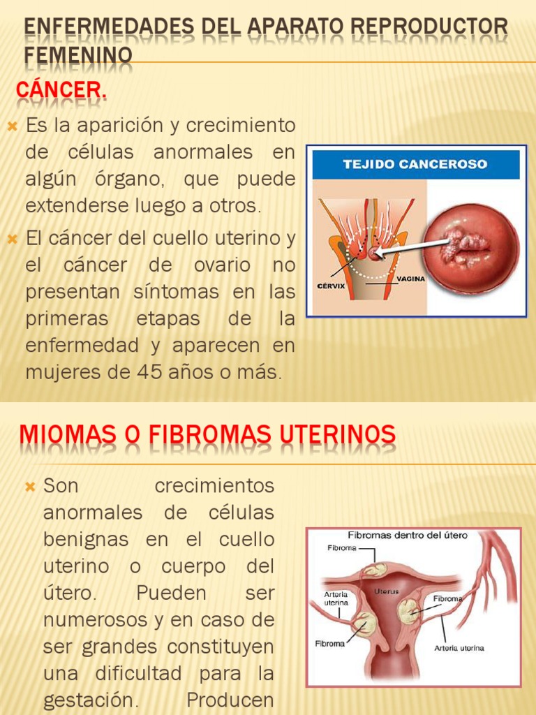 Enfermedades Del Aparato Reproductor Femenino y Masculino