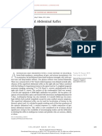 Superficial Abdominal Reflex: Images in Clinical Medicine