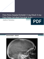 Skull Cervical X-Ray