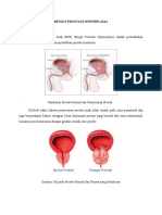 Benign Prostate Hyperplasia