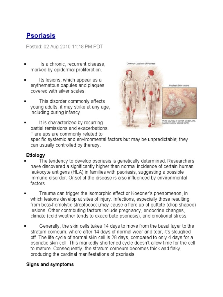 Understanding Psoriasis: Symptoms & Treatment | PDF | Psoriasis ...