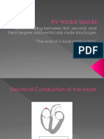 AV Nodal Blocks
