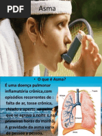 Asma.ppt