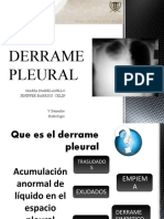 Derramepleural Final