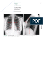 rx torax.pdf