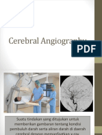 Referat Cerebral Angiography 