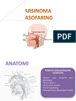 CA Nasofaring