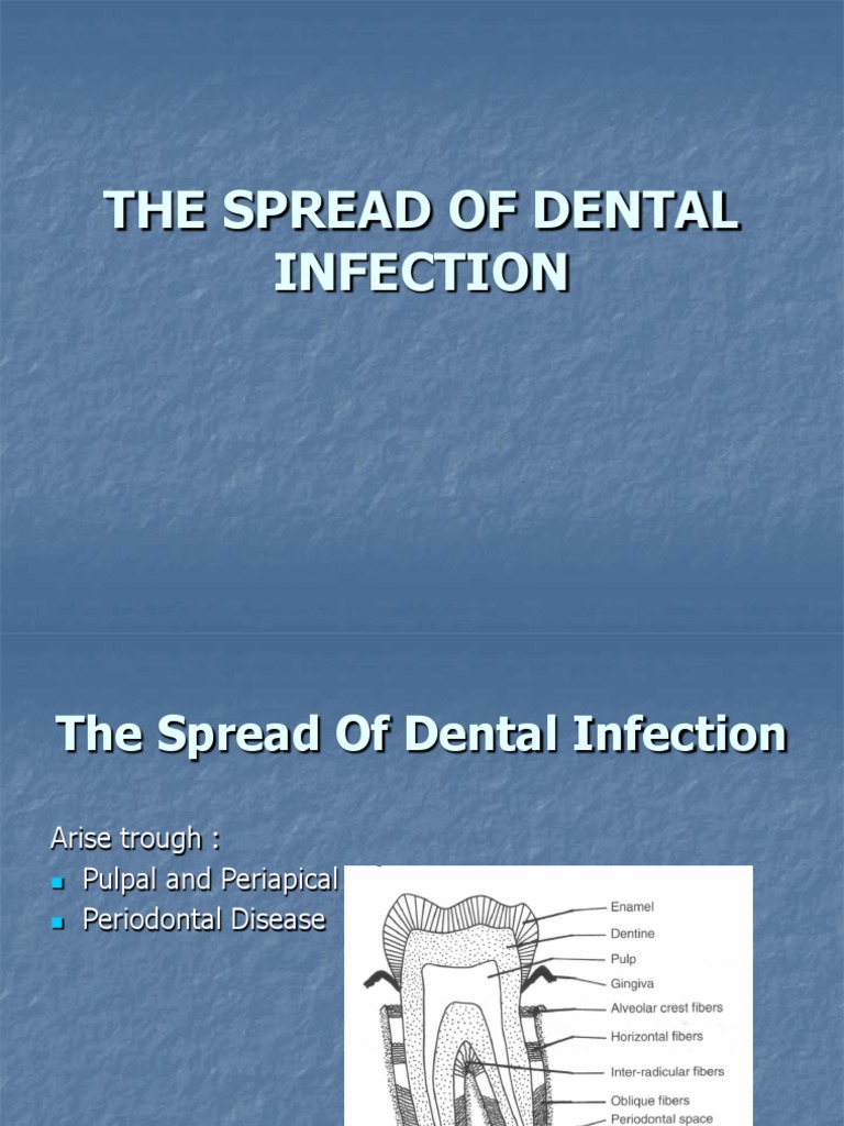 The Spread of Dental Infection PDF Inflammation Dentistry