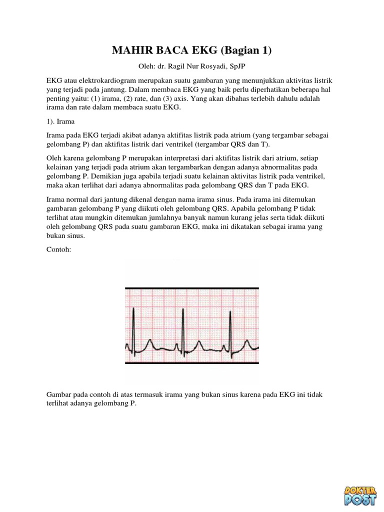 LEMBARAN PENUGASAN Interpretasi Gambaran EKG PDF