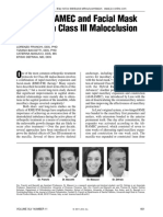 Early Alt-RAMEC and Facial Mask Protocol in Class III Malocclusion