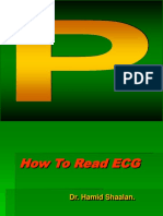 How to Read ECG