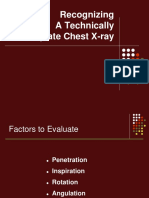 Chest x ray.ppt