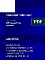 Cancerul pulmonar - factori de risc, simptome, investigatii, tratament