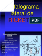 Ricketts - Cefalograma Lateral