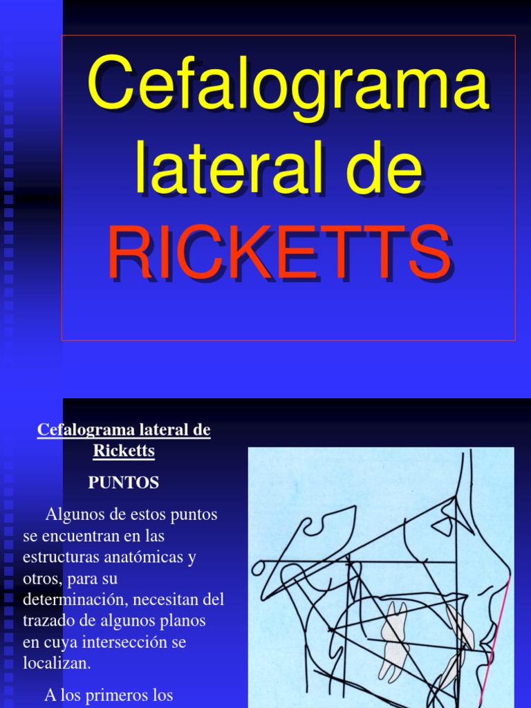Ricketts - Cefalograma Lateral | PDF | Anatomía humana | Ramas de ...
