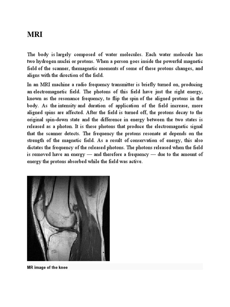 How MRI Works: Principles and Applications | PDF | Magnetic Resonance ...