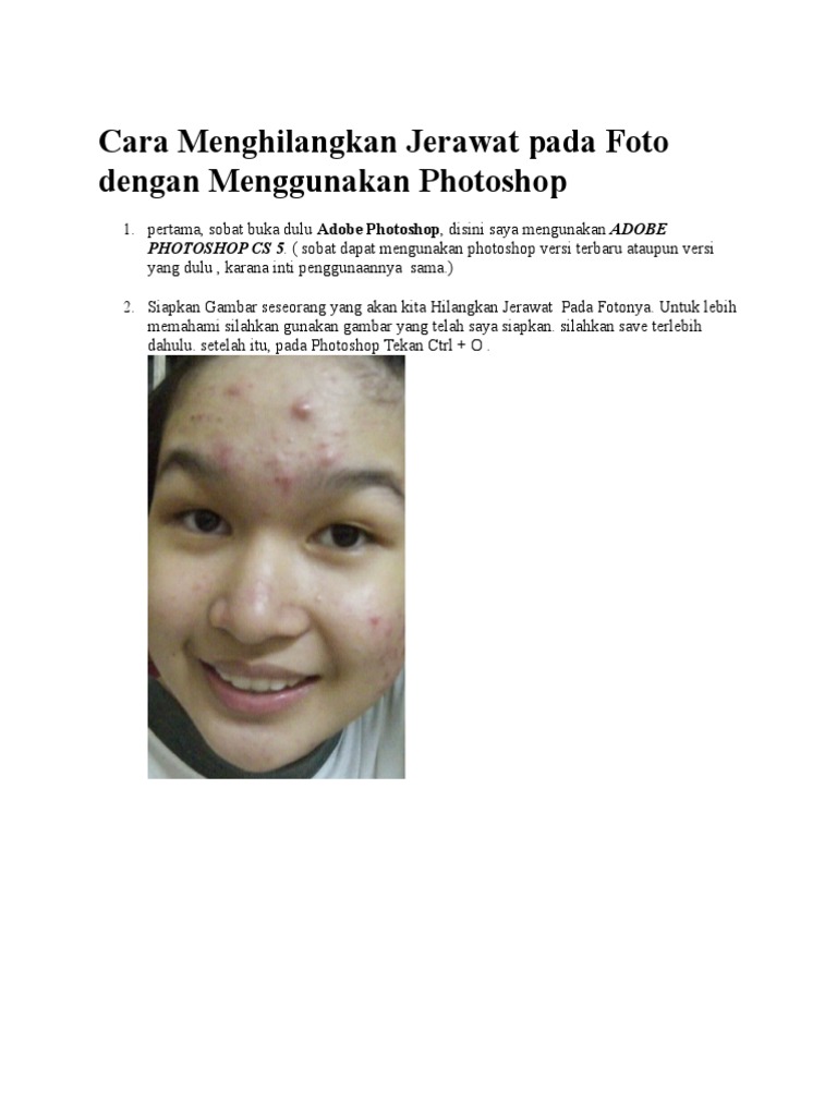 cara menghilangkan jerawat pada foto