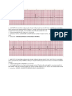 Soal Ekg 3