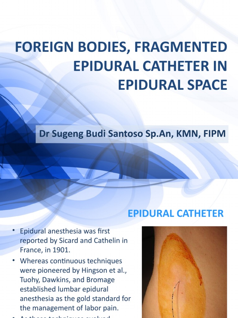 [Edit] Foreign Bodies, Fragmented Epidural Catheter in Epidural