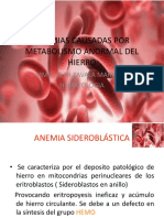 Anemia Sideroblastica