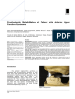 Prosthodontic Rehabilitation of Patient With Anterior Hyper