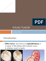 Wilms Tumor: by Nuzul Alimi