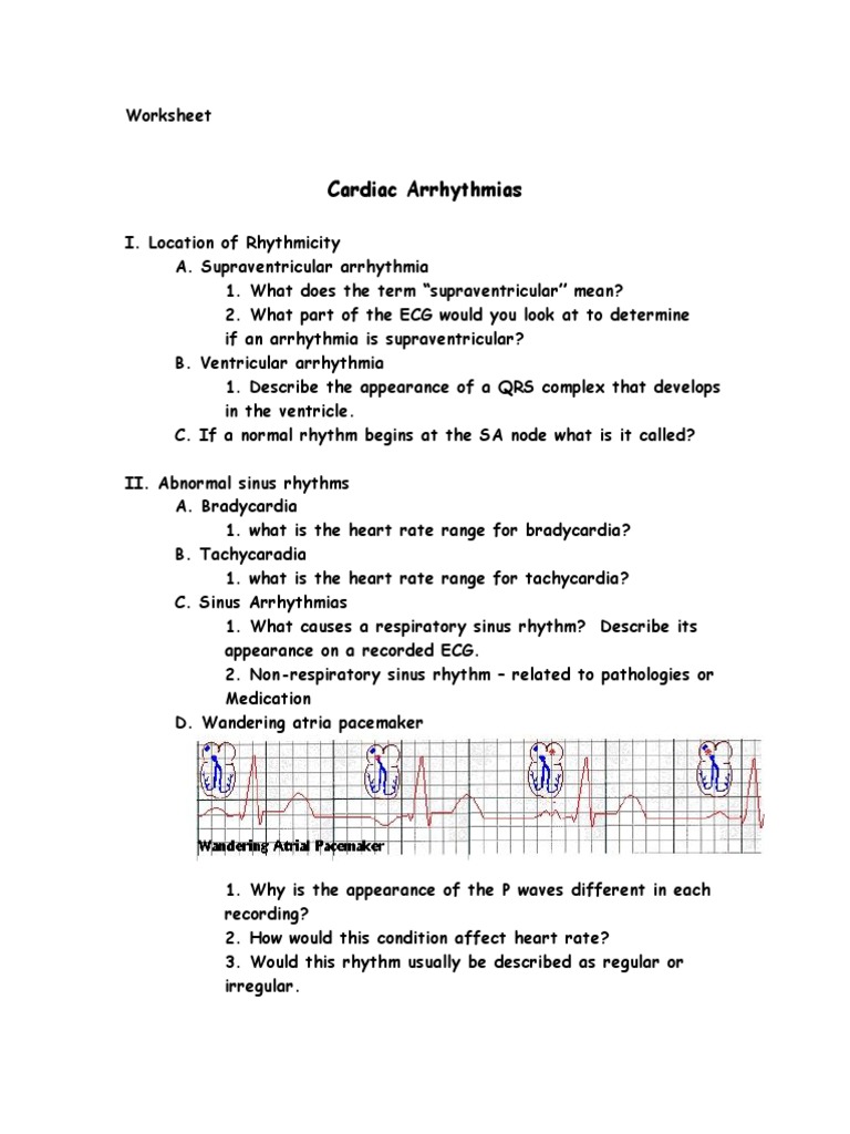 Unknown Arrhythmias Electrocardiography Heart
