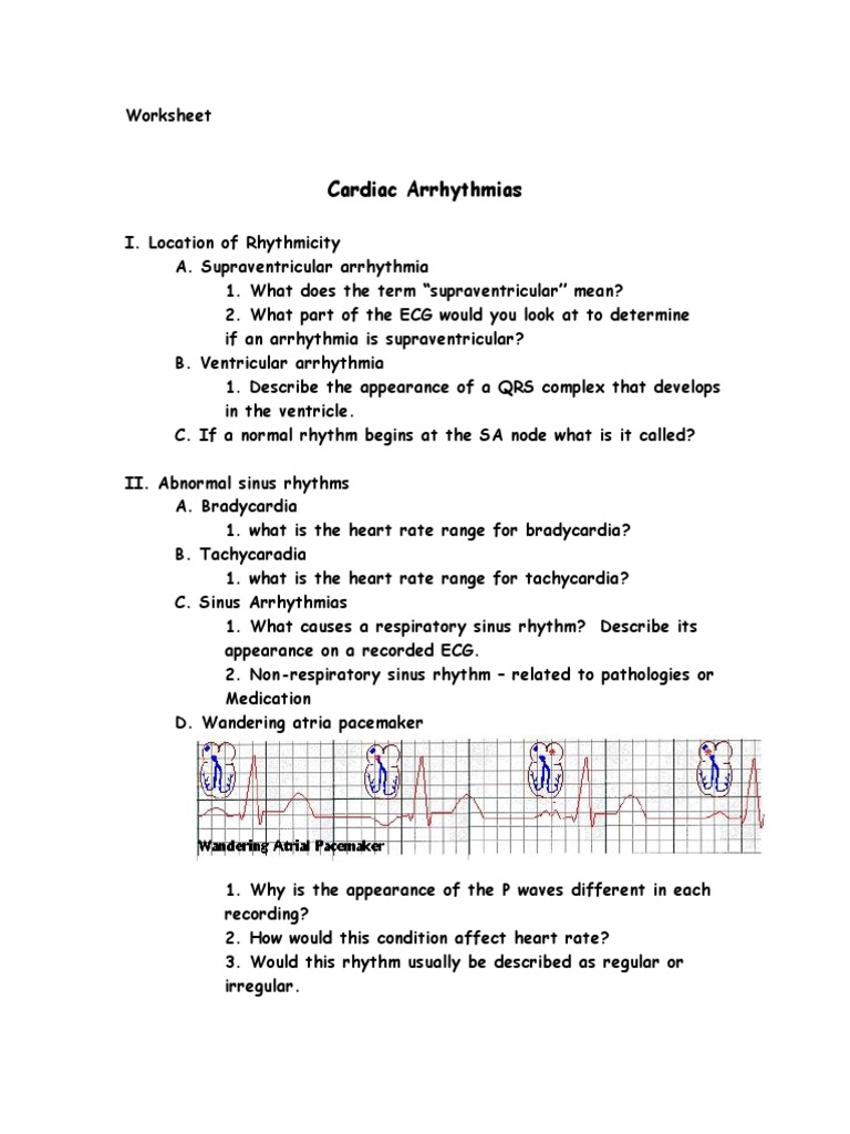 Unknown Arrhythmias Electrocardiography Heart