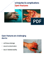 Open Fractures: Complex Hand Injuries & Complications
