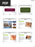 Úlcera Por Pressão