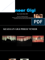 Veneer Gigi