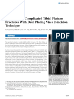 Treatment of Tibial Plateau Fractures Dual Plating Dual Incision