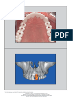 9. Prosthetically Directed Implant Parte I.pdf