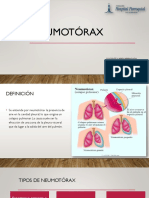 Neumotórax