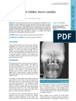 Susuk X Ray